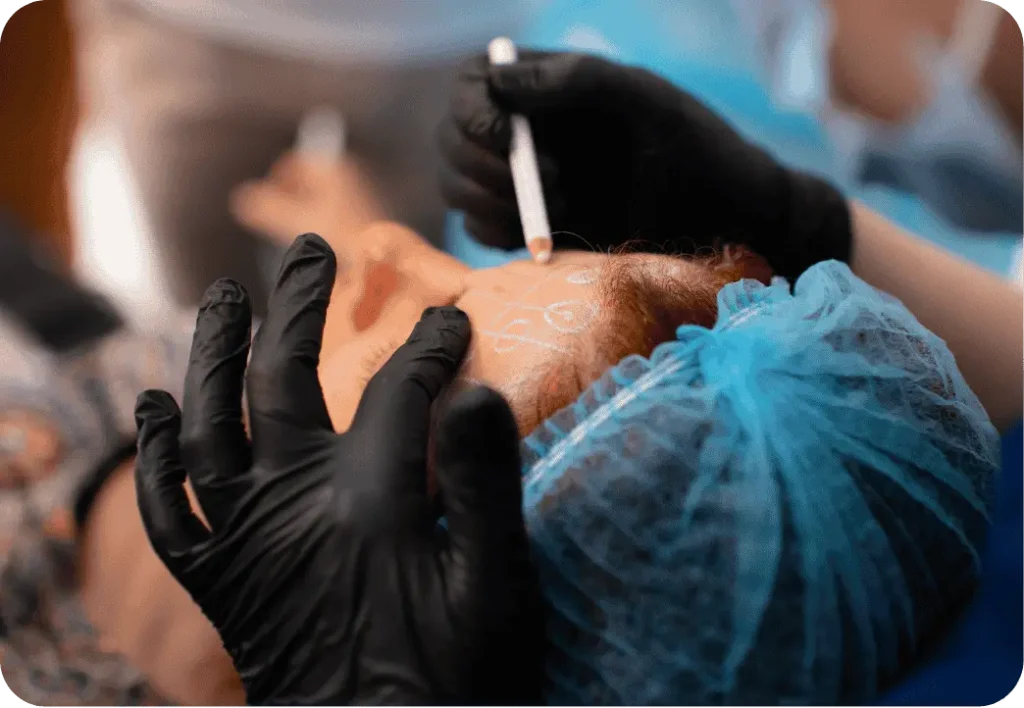 Complete Aesthetics Training 8 corso di medicina estetica